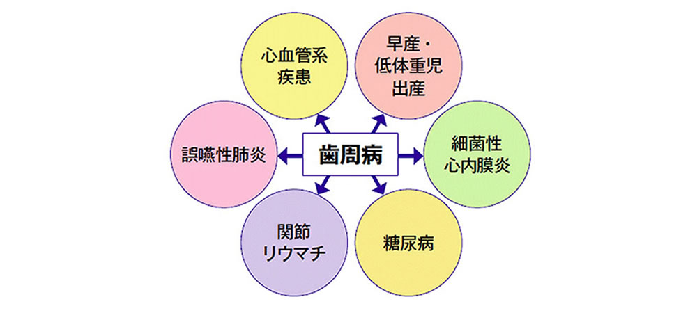 全身の病気や妊娠にも関係している歯周病