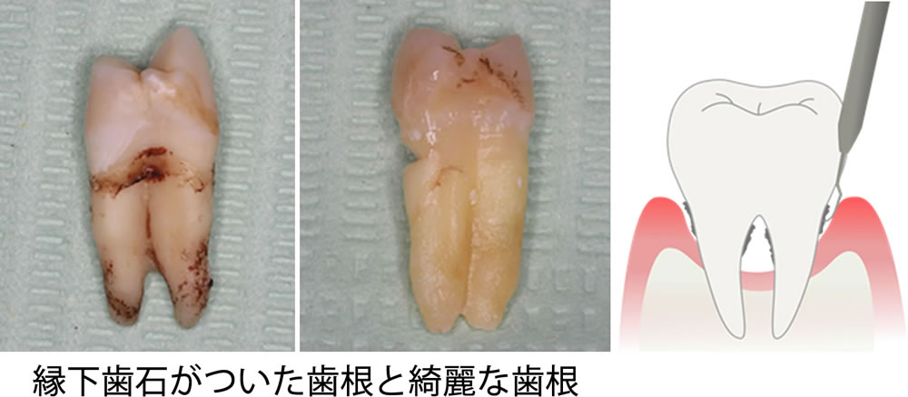 サンプルイメージ